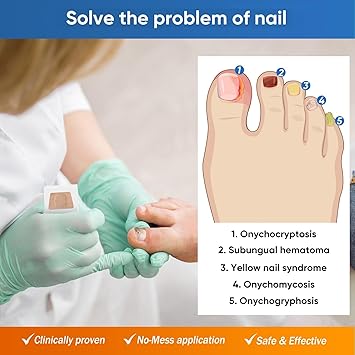 ClearTip™ - Fungal Nail Patches