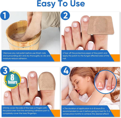 ClearTip™ - Fungal Nail Patches