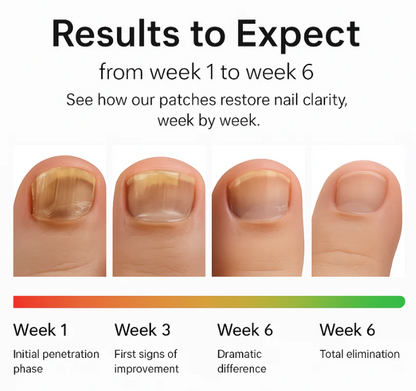 ClearTip™ - Fungal Nail Patches