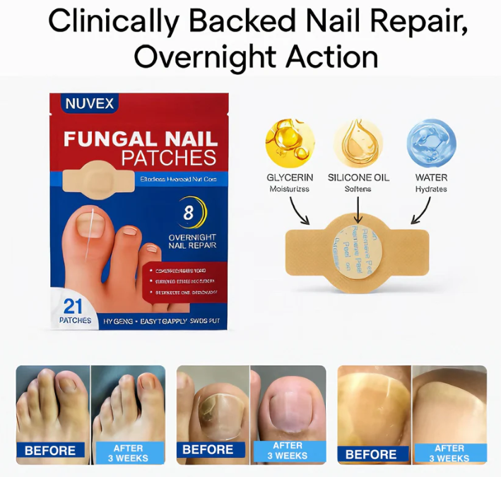 ClearTip™ - Fungal Nail Patches